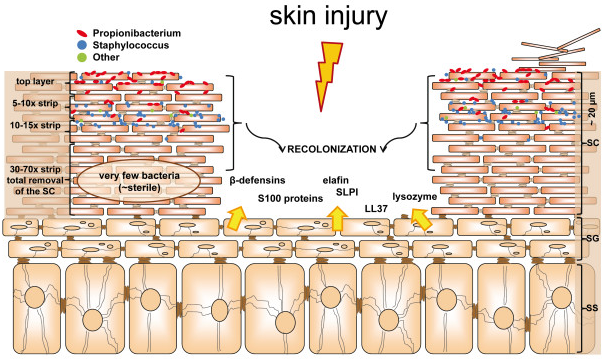 Seborrheic Dermatitis and Skin Infection - Treato